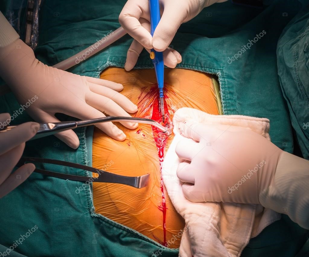 Cirurgia minimamente invasiva