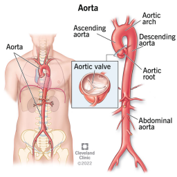 Figura 1. Anatomia da artéria aorta.
Fonte: Cleveland Clinic, 2022[3].